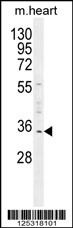 UPP2 Antibody (C-term) (Cat. #AP10995b) western blot analysis in mouse heart tissue lysates (35ug/lane).This demonstrates the UPP2 antibody detected the UPP2 protein (arrow).