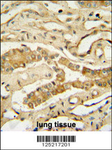 NDUF3 antibody (N-term) (Cat. #AP10989a) immunohistochemistry analysis in formalin fixed and paraffin embedded human lung tissue followed by peroxidase conjugation of the secondary antibody and DAB staining. This data demonstrates the use of the NDUF3 antibody (N-term) for immunohistochemistry. Clinical relevance has not been evaluated.