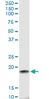 HSPB7 monoclonal antibody (M01), clone 3E11. Western Blot analysis of HSPB7 expression in human colon.