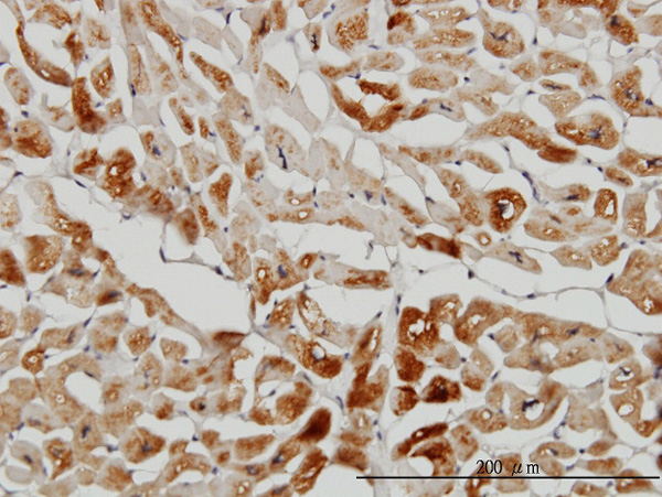 Immunoperoxidase of monoclonal antibody to HSPB7 on formalin-fixed paraffin-embedded human heart. [antibody concentration 3 ug/ml]