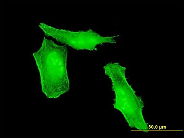 Immunofluorescence of monoclonal antibody to HRSP12 on HeLa cell . [antibody concentration 10 ug/ml]