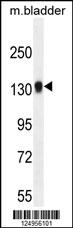 TDRD7 Antibody (C-term) (Cat. #AP10982b) western blot analysis in mouse bladder tissue lysates (35ug/lane).This demonstrates the TDRD7 antibody detected the TDRD7 protein (arrow).