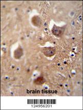 TDRD7 antibody (C-term) (Cat. #AP10982b) immunohistochemistry analysis in formalin fixed and paraffin embedded human brain tissue followed by peroxidase conjugation of the secondary antibody and DAB staining. This data demonstrates the use of the TDRD7 antibody (C-term) for immunohistochemistry. Clinical relevance has not been evaluated.
