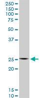 HOXC12 monoclonal antibody (M01), clone 1C6. Western Blot analysis of HOXC12 expression in Raw 264.7((Cat # AT2418a )