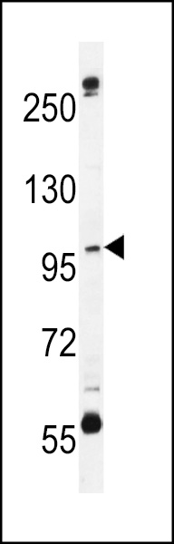 CA026 Antibody (N-term) (Cat. #AP10980a) western blot analysis in MDA-MB435 cell line lysates (35ug/lane).This demonstrates the CA026 antibody detected the CA026 protein (arrow).