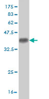 Antibody Reactive Against Recombinant Protein.Western Blot detection against Immunogen (35.64 KDa) . 
