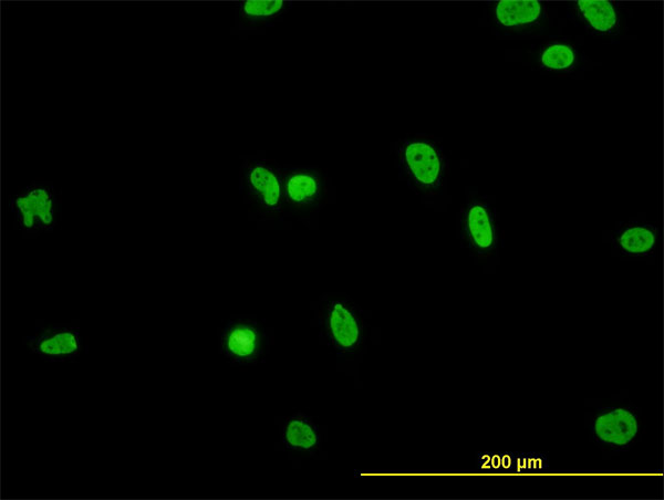 Immunofluorescence of monoclonal antibody to HNRNPG-T on HeLa cell. [antibody concentration 10 ug/ml]