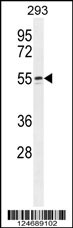 WIPF2 Antibody (C-term) (Cat. #AP10977b) western blot analysis in 293 cell line lysates (35ug/lane).This demonstrates the WIPF2 antibody detected the WIPF2 protein (arrow).