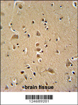 WIPF2 antibody (C-term) (Cat. #AP10977b) immunohistochemistry analysis in formalin fixed and paraffin embedded human brain tissue followed by peroxidase conjugation of the secondary antibody and DAB staining. This data demonstrates the use of the WIPF2 antibody (C-term) for immunohistochemistry. Clinical relevance has not been evaluated.