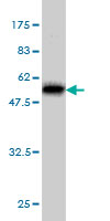Antibody Reactive Against Recombinant Protein.Western Blot detection against Immunogen (51.81 KDa) . 