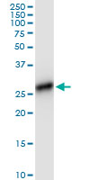 HLA-DRB4 monoclonal antibody (M01), clone 4C8. Western Blot analysis of HLA-DRB4 expression in human kidney.