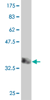 Antibody Reactive Against Recombinant Protein.Western Blot detection against Immunogen (36.74 KDa) . 