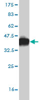 Antibody Reactive Against Recombinant Protein.Western Blot detection against Immunogen (37.84 KDa) . 