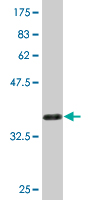 Antibody Reactive Against Recombinant Protein.Western Blot detection against Immunogen (36.41 KDa) . 