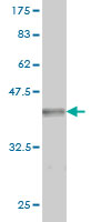 Antibody Reactive Against Recombinant Protein.Western Blot detection against Immunogen (36.74 KDa) . 