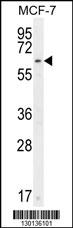 CTDSPL2 Antibody (N-term) (Cat. #AP10938a) western blot analysis in MCF-7 cell line lysates (35ug/lane).This demonstrates the CTDSPL2 antibody detected the CTDSPL2 protein (arrow).