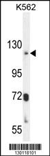 ATP8A2 Antibody (N-term) (Cat. #AP10934a) western blot analysis in K562 cell line lysates (35ug/lane).This demonstrates the ATP8A2 antibody detected the ATP8A2 protein (arrow).