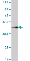 Antibody Reactive Against Recombinant Protein.Western Blot detection against Immunogen (35.64 KDa) . 