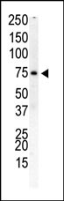 Western blot analysis of anti-PIP5K1B Pab (Cat. #AP8038a) in human placenta cell lysate. PIP5K1B (arrow) was detected using purified Pab. Secondary HRP-anti-rabbit was used for signal visualization with chemiluminescence.