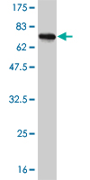 Antibody Reactive Against Recombinant Protein.Western Blot detection against Immunogen (72.27 KDa) . 