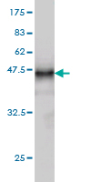 Antibody Reactive Against Recombinant Protein.Western Blot detection against Immunogen (37.84 KDa) . 