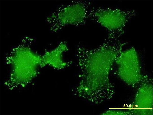 Immunofluorescence of monoclonal antibody to LSM3 on HeLa cell . [antibody concentration 10 ug/ml]