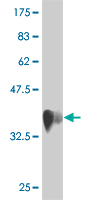 Antibody Reactive Against Recombinant Protein.Western Blot detection against Immunogen (36.74 KDa) . 