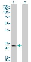 Western Blot analysis of LOC51136 expression in transfected 293T cell line by LOC51136 monoclonal antibody (M01), clone 4H7.Lane 1: LOC51136 transfected lysate(23.2 KDa).Lane 2: Non-transfected lysate.