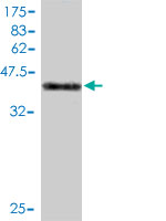 Antibody Reactive Against Recombinant Protein.Western Blot detection against Immunogen (45.21 KDa) . 