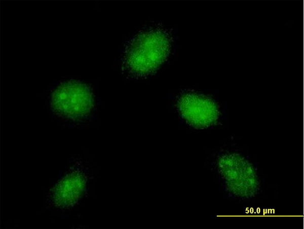 Immunofluorescence of monoclonal antibody to DYDC1 on HeLa cell . [antibody concentration 10 ug/ml]