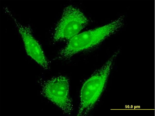 Immunofluorescence of monoclonal antibody to LMO7 on HeLa cell . [antibody concentration 10 ug/ml]