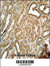 EFHB antibody (N-term) (Cat. #AP10904a) immunohistochemistry analysis in formalin fixed and paraffin embedded human kidney tissue followed by peroxidase conjugation of the secondary antibody and DAB staining. This data demonstrates the use of the EFHB antibody (N-term) for immunohistochemistry. Clinical relevance has not been evaluated.