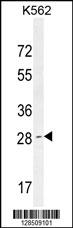 OR52D1 Antibody (C-term) (Cat. #AP10897b) western blot analysis in K562 cell line lysates (35ug/lane).This demonstrates the OR52D1 antibody detected the OR52D1 protein (arrow).