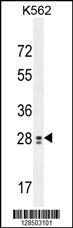 TEX13B Antibody (C-term) (Cat. #AP10895b) western blot analysis in K562 cell line lysates (35ug/lane).This demonstrates the TEX13B antibody detected the TEX13B protein (arrow).