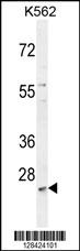 MCART2 Antibody (N-term) (Cat. #AP10890a) western blot analysis in K562 cell line lysates (35ug/lane).This demonstrates the MCART2 antibody detected the MCART2 protein (arrow).