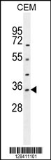 LDHAL6A Antibody (Center) (Cat. #AP10888c) western blot analysis in CEM cell line lysates (35ug/lane).This demonstrates the LDHAL6A antibody detected the LDHAL6A protein (arrow).