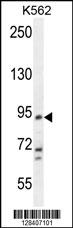 KCNH4 Antibody (N-term) (Cat. #AP10887a) western blot analysis in K562 cell line lysates (35ug/lane).This demonstrates the KCNH4 antibody detected the KCNH4 protein (arrow).