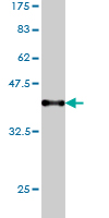 Antibody Reactive Against Recombinant Protein.Western Blot detection against Immunogen (37.84 KDa) . 