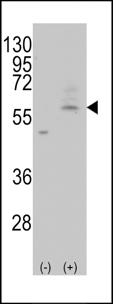 Western blot analysis of PMAT(Slc29a4) (arrow) using rabbit polyclonal PMAT(Slc29a4) Antibody (C-term) (Cat.#AP1087b). 293 cell lysates (2 ug/lane) either nontransfected (Lane 1) or transiently transfected with the PMAT(Slc29a4) gene (Lane 2) (Origene Technologies).