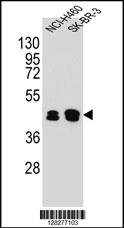 KRT80 Antibody (C-term) (Cat. #AP10874b) western blot analysis in NCI-H460,SK-BR-3 cell line lysates (35ug/lane).This demonstrates the KRT80 antibody detected the KRT80 protein (arrow).
