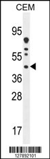 DNAJC22 Antibody (C-term) (Cat. #AP10871b) western blot analysis in CEM cell line lysates (35ug/lane).This demonstrates the DNAJC22 antibody detected the DNAJC22 protein (arrow).