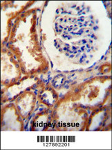 DNAJC22 antibody (C-term) (Cat. #AP10871b) immunohistochemistry analysis in formalin fixed and paraffin embedded human kidney tissue followed by peroxidase conjugation of the secondary antibody and DAB staining. This data demonstrates the use of the DNAJC22 antibody (C-term) for immunohistochemistry. Clinical relevance has not been evaluated.