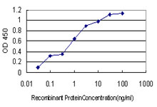Detection limit for recombinant GST tagged COL20A1 is approximately 0.03ng/ml as a capture antibody.