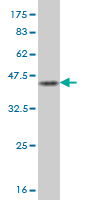 Antibody Reactive Against Recombinant Protein.Western Blot detection against Immunogen (41.8 KDa) . 