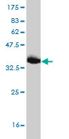 Antibody Reactive Against Recombinant Protein.Western Blot detection against Immunogen (34.43 KDa) . 