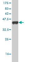 Antibody Reactive Against Recombinant Protein.Western Blot detection against Immunogen (36.52 KDa) . 