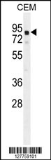 GLB1L2 Antibody (C-term) (Cat. #AP10868b) western blot analysis in CEM cell line lysates (35ug/lane).This demonstrates the GLB1L2 antibody detected the GLB1L2 protein (arrow).