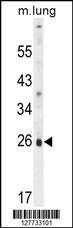 PQLC1 Antibody (Center) (Cat. #AP10867c) western blot analysis in mouse lung tissue lysates (35ug/lane).This demonstrates the PQLC1 antibody detected the PQLC1 protein (arrow).