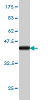 Antibody Reactive Against Recombinant Protein.Western Blot detection against Immunogen (36.63 KDa) .