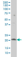 ITGB3BP monoclonal antibody (M01), clone 3F6 Western Blot analysis of ITGB3BP expression in A-431 ( (Cat # AT2569a )